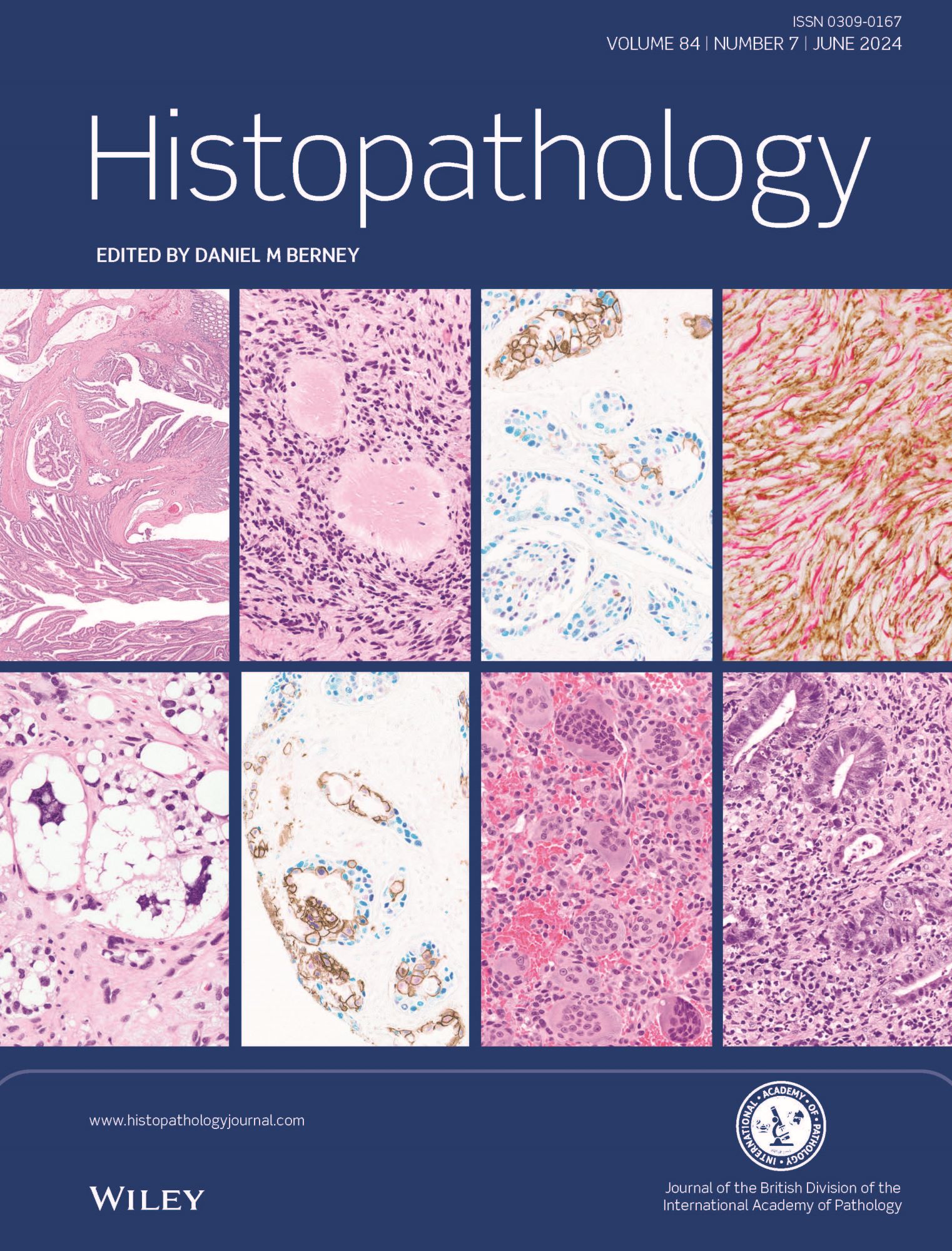 Histopathology Journal: Latest Issue Now Available image